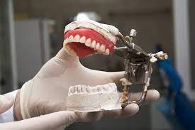 Understanding the Workflow in a Cutting-Edge Dental Lab